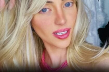 Laudo aponta causa da morte de influenciadora conhecida como ‘Barbie humana’