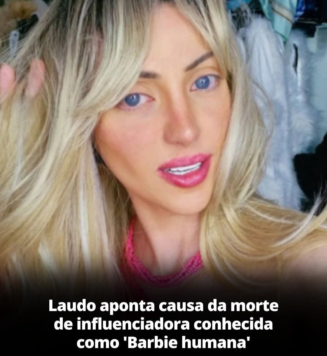 Laudo aponta causa da morte de influenciadora conhecida como ‘Barbie humana’