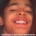 Jovem morre após sofrer queimaduras enquanto faziacafé