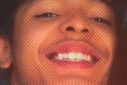 Jovem morre após sofrer queimaduras enquanto faziacafé