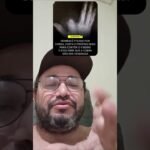 HOMEM PICADO POR COBRA CORTA O PRÓPRIO DEDO PARA CONTER O VENENO E DESCOBRE QUE ELA NÃO ERA VENENOSA !