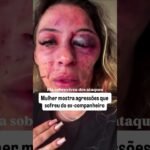 Mulher mostra agressões qu sofreu do ex-companheiro!