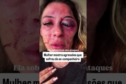 Mulher mostra agressões qu sofreu do ex-companheiro!