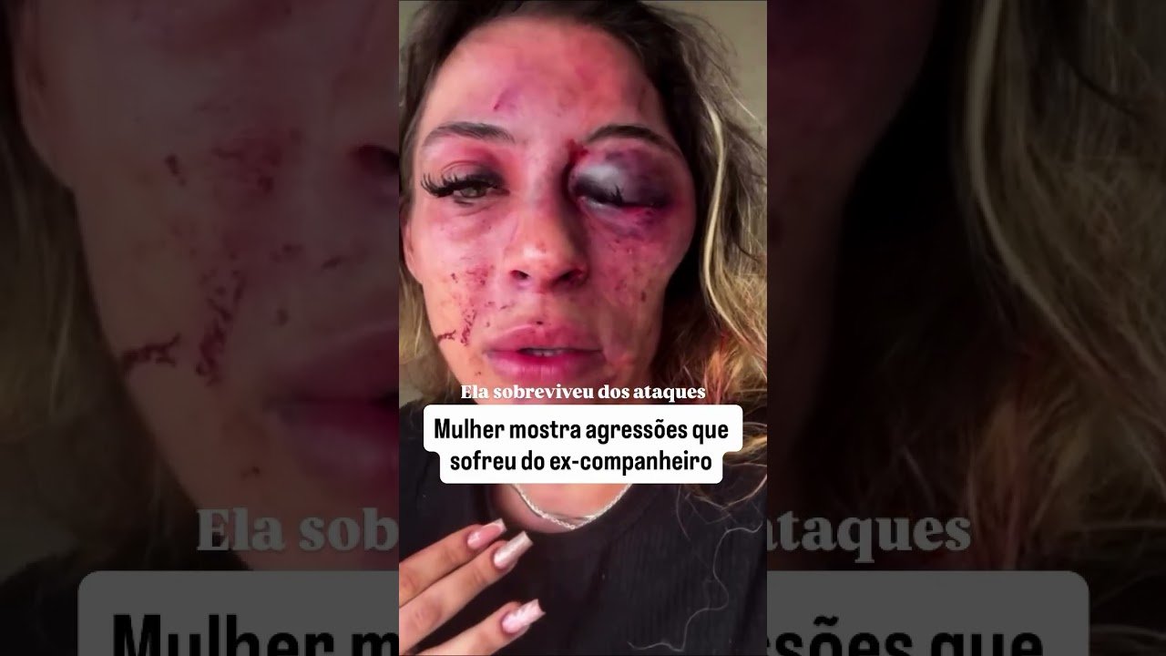 Mulher mostra agressões qu sofreu do ex-companheiro!