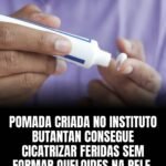 POMADA CRIADA NO INSTITUTO BUTANTAN CONSEGUE CICATRIZAR FERIDAS SEMFORMAR QUELOIDES NA PELE