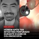 HOMEM APÓS TER INTESTINO PERFURADODURANTE EXAME DECOLONOSCOPIA