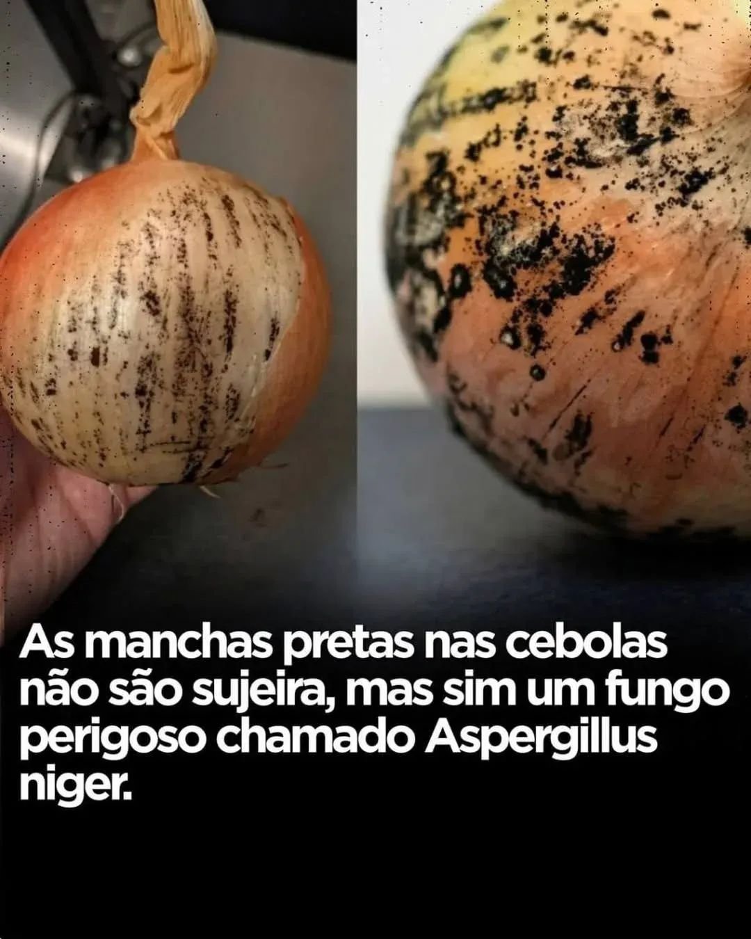 As manchas pretas nas cebolasnão são sujeira, mas sim um fungo perigoso chamado Aspergillus niger