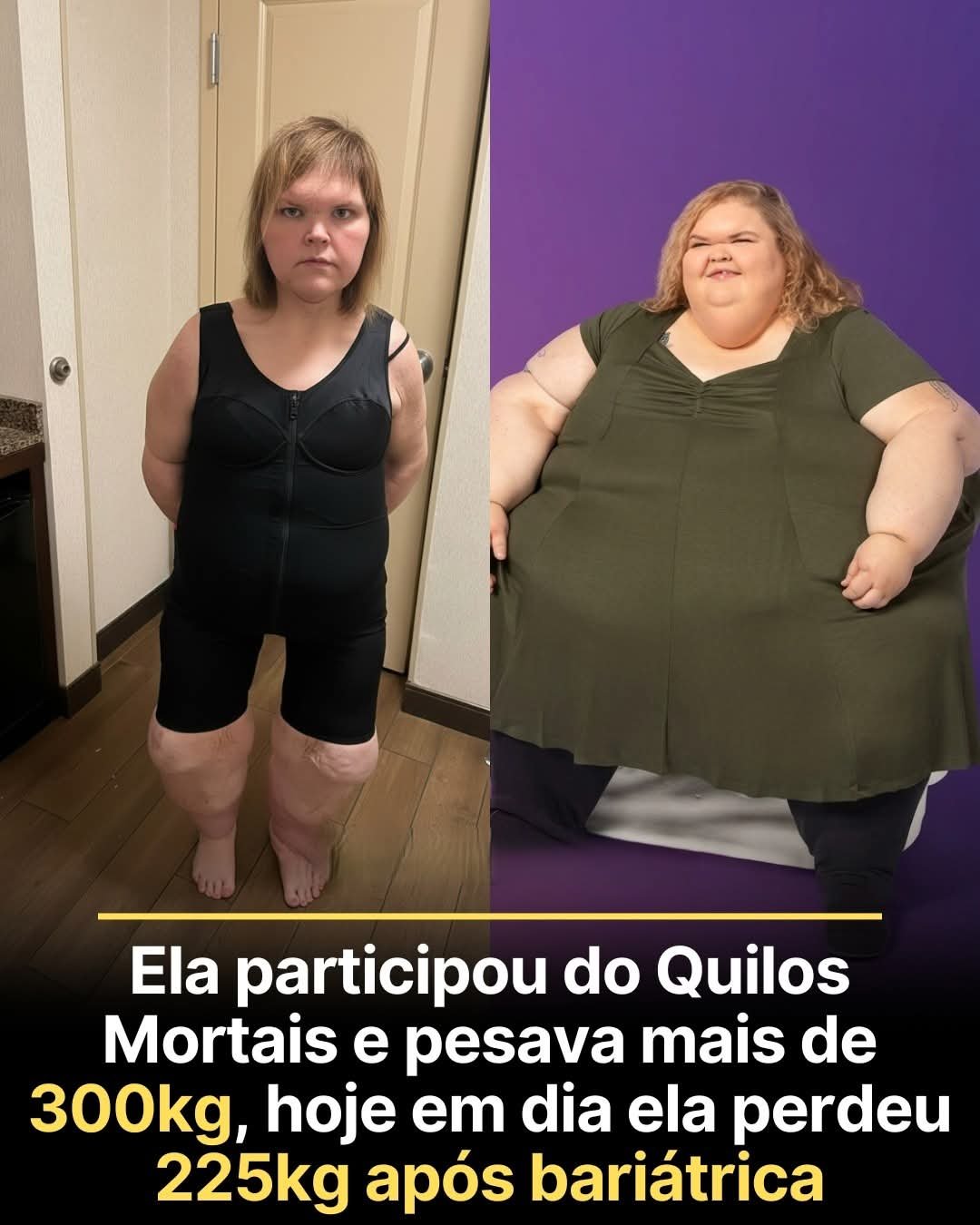 Ela participou do Quilos Mortais e pesava mais de 300kg, hoje em dia ela perdeu 225kg após bariátrica