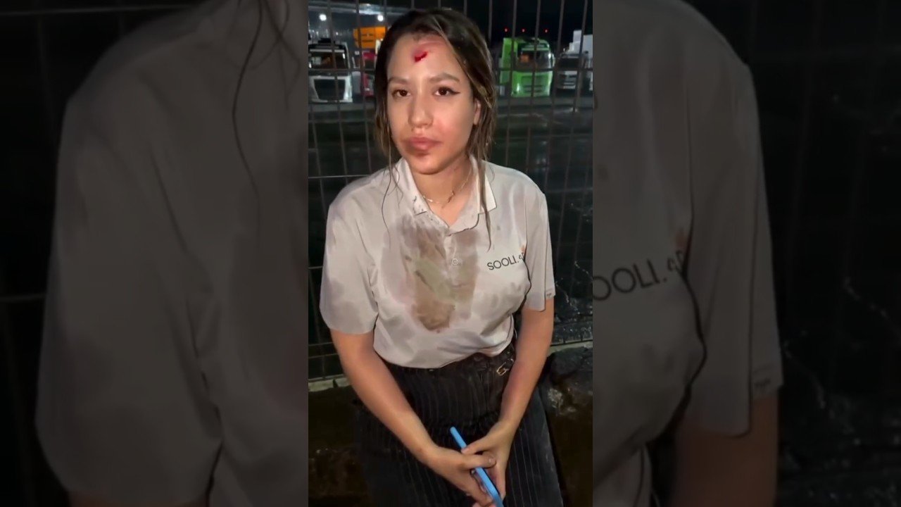 Foi Deus que salvou a vida dessa jovem após gravíssimo acidente !