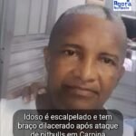 Idoso é escalpelado e tem braço dilacerado após ataque de pitbulls em Carpina