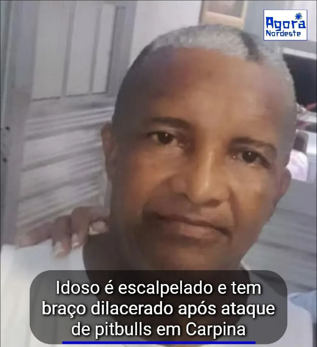 Idoso é escalpelado e tem braço dilacerado após ataque de pitbulls em Carpina