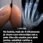 Na Suécia, mais de 4 mil pessoas já vivem com microchips sob a pele. Eles são usados para abrir portas, substituir cartões e armazenar dados pessoais.