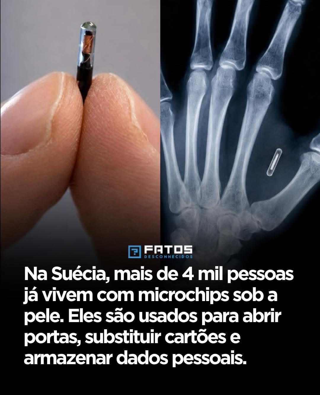 Na Suécia, mais de 4 mil pessoas já vivem com microchips sob a pele. Eles são usados para abrir portas, substituir cartões e armazenar dados pessoais.