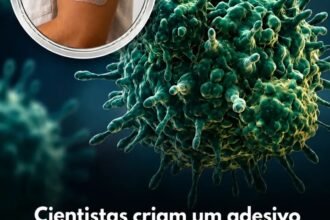 Cientistas criam um adesivo vestível que mata 97% das células cancerígenas e evita cirurgia