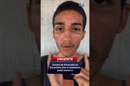 Jovem de Alvorada no Tocantins sem tratamento pede socorro ! 🥹 Jovem de Alvorada no Tocantins sem tratamento pede socorro ! 🥹