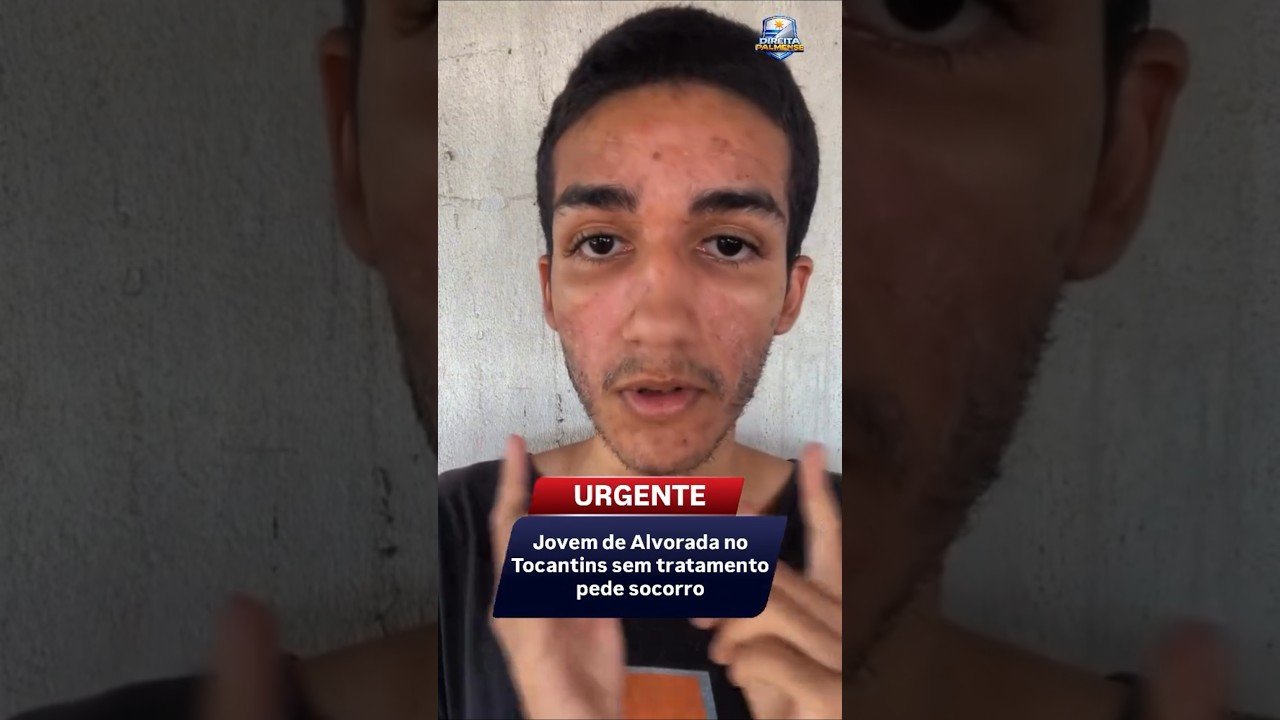 Jovem de Alvorada no Tocantins sem tratamento pede socorro ! 🥹
