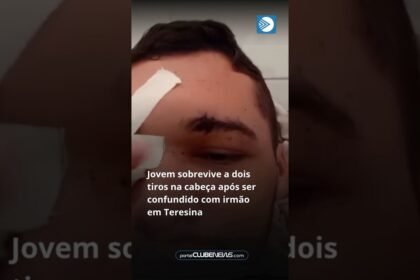 Jovem sobrevive a dois tiros na cabeça após ser confundido com irmão em Teresina