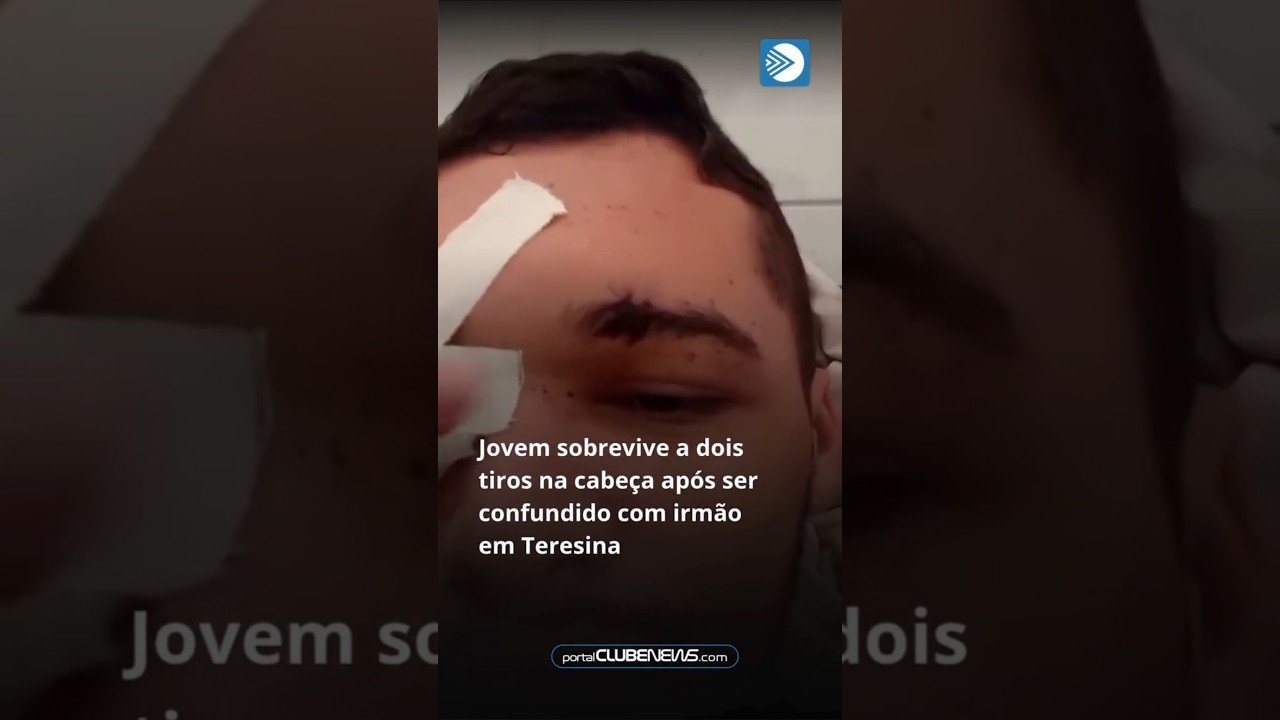 Jovem sobrevive a dois tiros na cabeça após ser confundido com irmão em Teresina