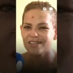 Recebe alta mulher atacada pelo ex com água quente, marteladas e facadas em Dois Carneiros Recebe alta mulher atacada pelo ex com água quente, marteladas e facadas em Dois Carneiros