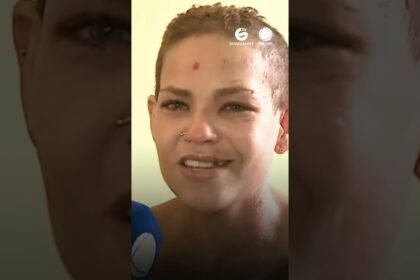 Recebe alta mulher atacada pelo ex com água quente, marteladas e facadas em Dois Carneiros