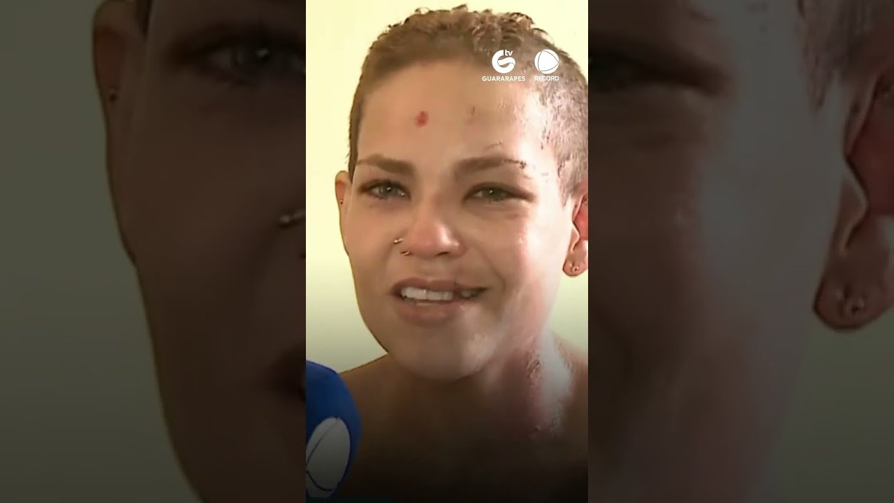 Recebe alta mulher atacada pelo ex com água quente, marteladas e facadas em Dois Carneiros