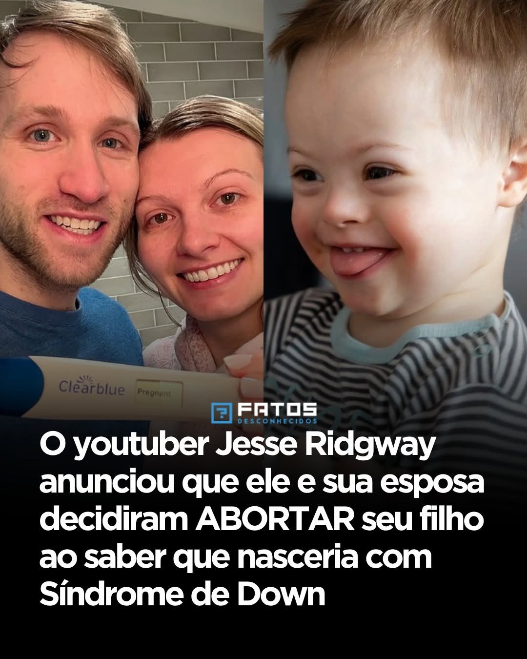 O youtuber Jesse Ridgway anunciou que ele e sua esposa decidiram ABORTAR seu filho ao saber que nasceria com Síndrome de Down O youtuber Jesse Ridgway anunciou que ele e sua esposa decidiram ABORTAR seu filho ao saber que nasceria com Síndrome de Down