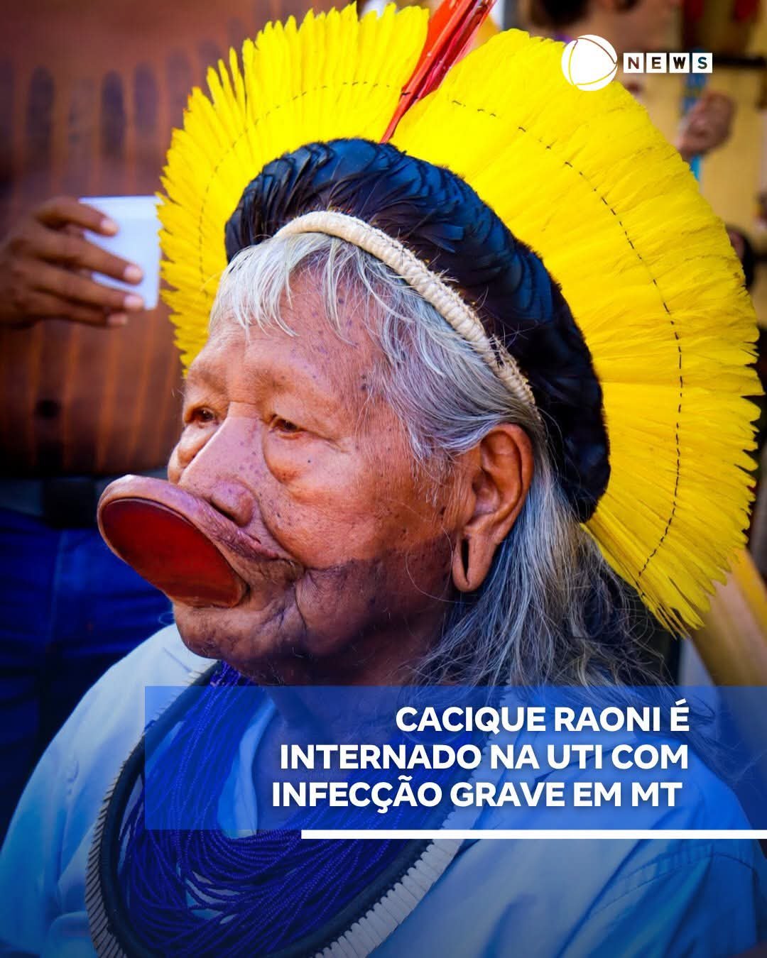 CACIQUE RAONI É INTERNADO NA UTI COM INFECÇÃO GRAVE EM MT CACIQUE RAONI É INTERNADO NA UTI COM INFECÇÃO GRAVE EM MT