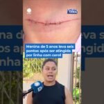 Menina de 5 anos leva sei pontos após ser atingida por linha com cerol em São Paulo!