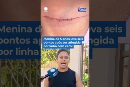 Menina de 5 anos leva sei pontos após ser atingida por linha com cerol em São Paulo! Menina de 5 anos leva sei pontos após ser atingida por linha com cerol em São Paulo!