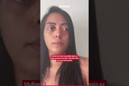 Mulher diz viver escondida após ex tentar arrancar seu olho: ‘Ele está solto, eu é que estou presa Mulher diz viver escondida após ex tentar arrancar seu olho: ‘Ele está solto, eu é que estou presa