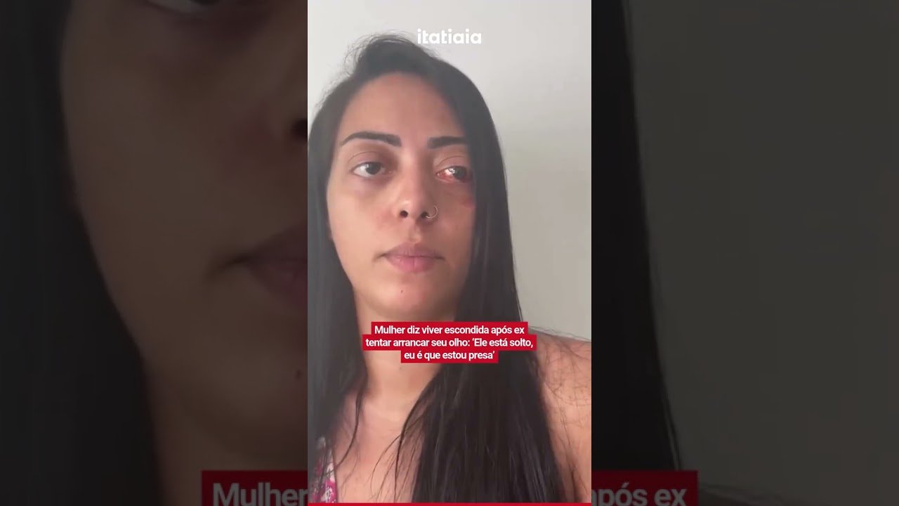 Mulher diz viver escondida após ex tentar arrancar seu olho: ‘Ele está solto, eu é que estou presa Mulher diz viver escondida após ex tentar arrancar seu olho: ‘Ele está solto, eu é que estou presa