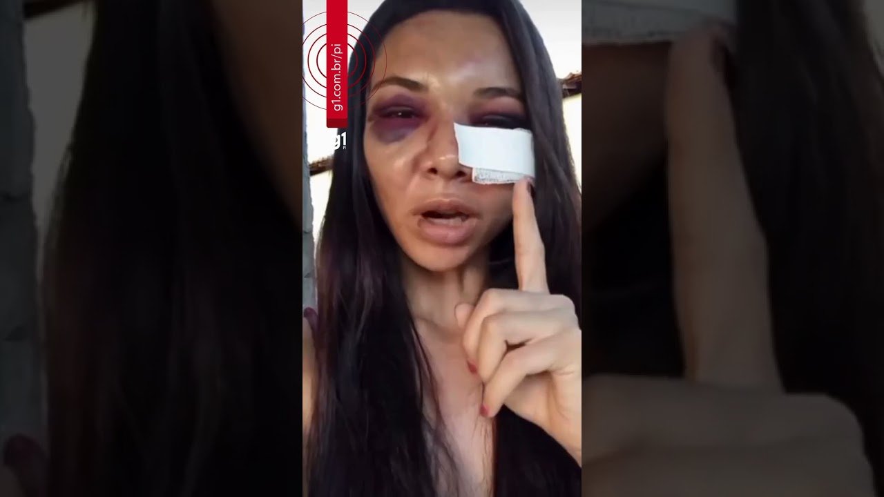 Mulher espancada pelo companheiro no Pl diz que foi a 1º agressão: ‘isso não é para se perdoar Mulher espancada pelo companheiro no Pl diz que foi a 1º agressão: ‘isso não é para se perdoar