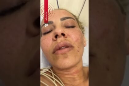 Mulher espancada pelo ex-noivo grava vídeo em hospital contando como foi o crime ! Mulher espancada pelo ex-noivo grava vídeo em hospital contando como foi o crime !