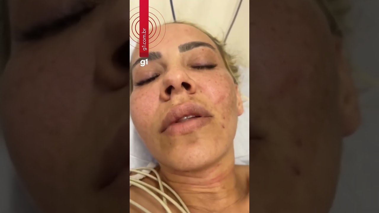 Mulher espancada pelo ex-noivo grava vídeo em hospital contando como foi o crime ! Mulher espancada pelo ex-noivo grava vídeo em hospital contando como foi o crime !
