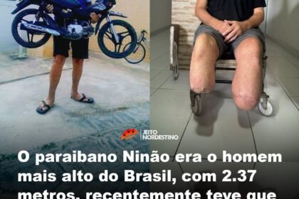O paraibano Ninão era o homem mais alto do Brasil, com 2.37 metros, recentemente teve que amputar as duas pernas, ele descobriu o gigantismo aos 14 anos quanto media 1,95 metro O paraibano Ninão era o homem mais alto do Brasil, com 2.37 metros, recentemente teve que amputar as duas pernas, ele descobriu o gigantismo aos 14 anos quanto media 1,95 metro