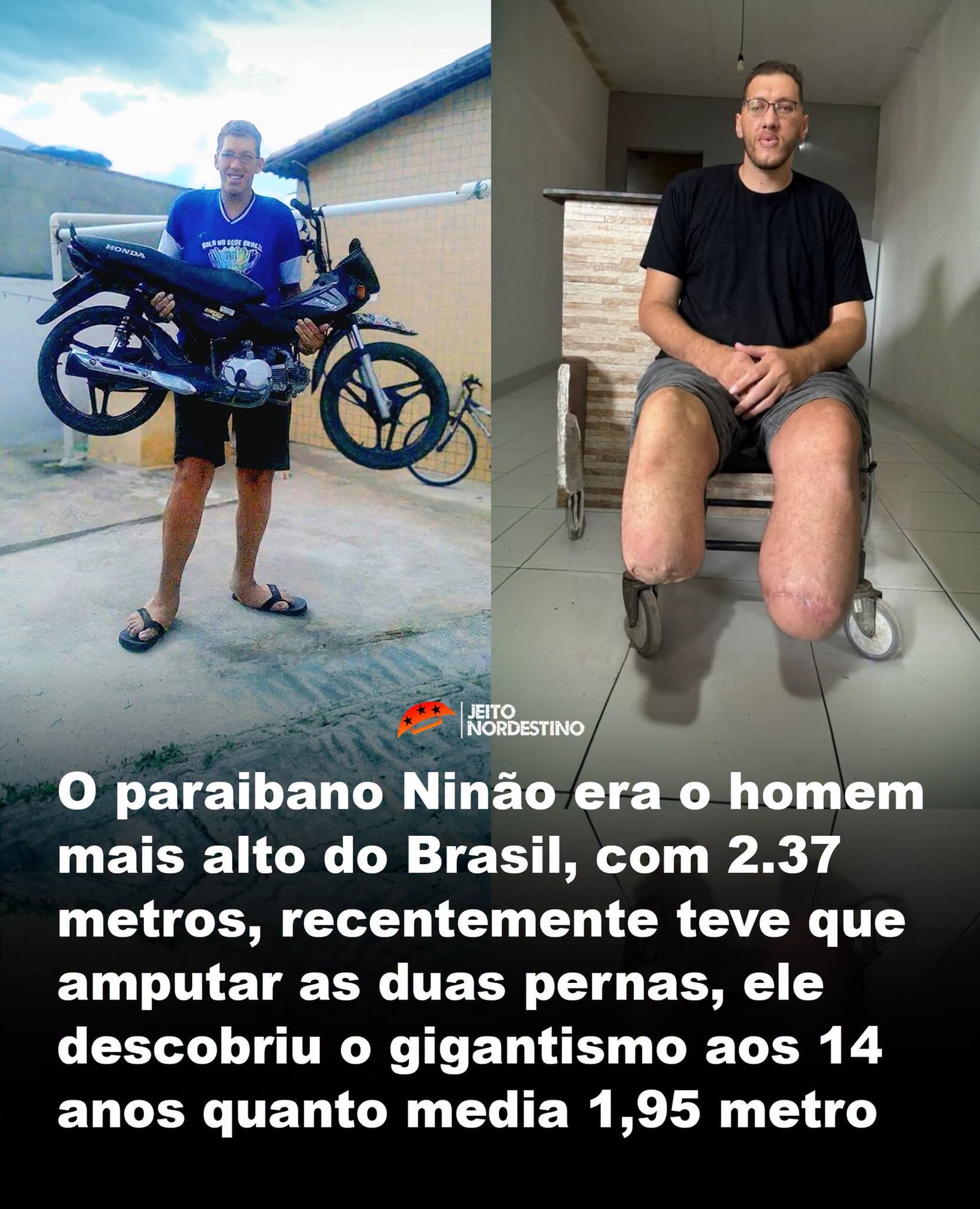 O paraibano Ninão era o homem mais alto do Brasil, com 2.37 metros, recentemente teve que amputar as duas pernas, ele descobriu o gigantismo aos 14 anos quanto media 1,95 metro O paraibano Ninão era o homem mais alto do Brasil, com 2.37 metros, recentemente teve que amputar as duas pernas, ele descobriu o gigantismo aos 14 anos quanto media 1,95 metro