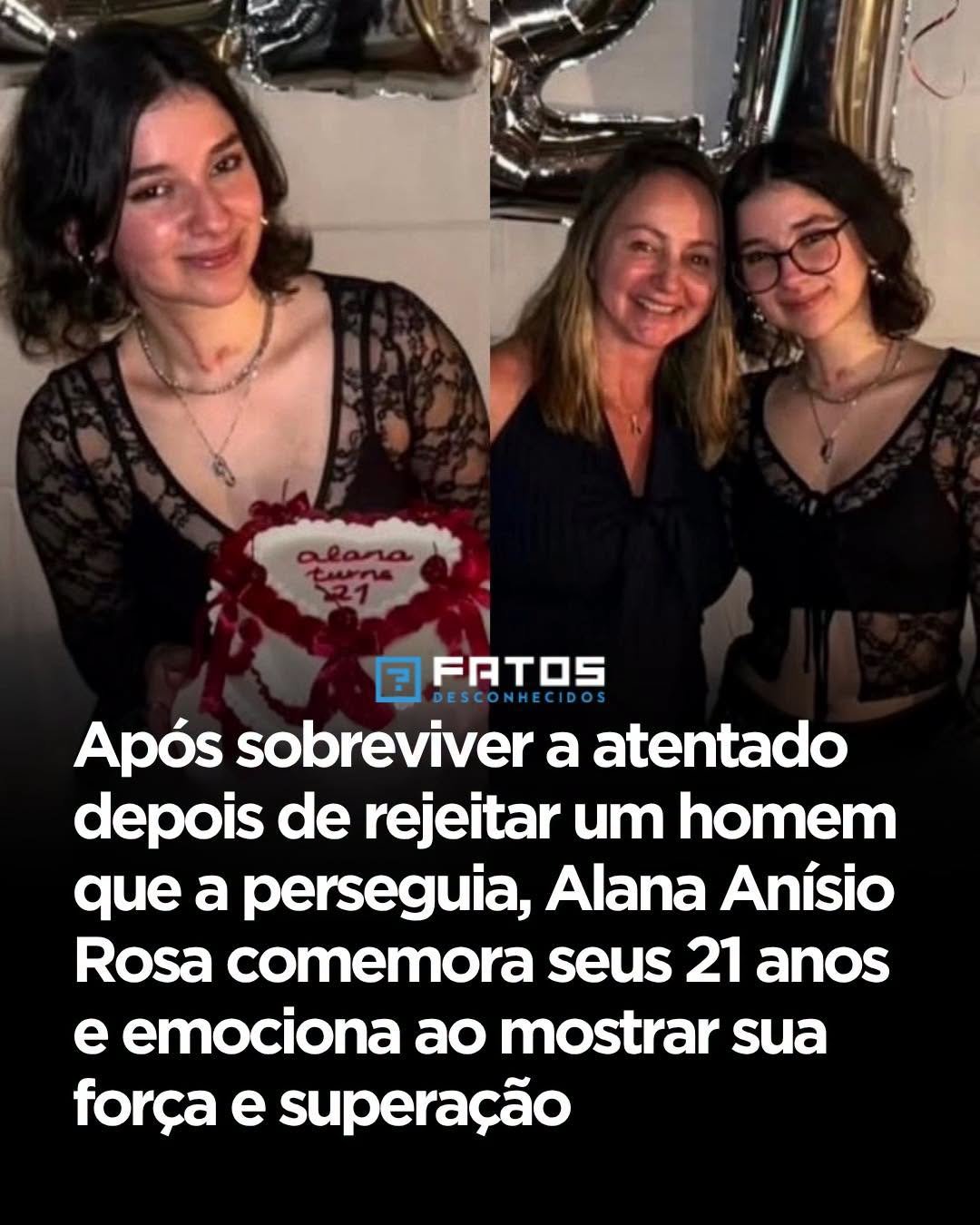 Após sobreviver a atentado depois de rejeitar um homem que a perseguia, Alana Anísio Rosa comemora seus 21 anos e emociona ao mostrar sua força e superação Após sobreviver a atentado depois de rejeitar um homem que a perseguia, Alana Anísio Rosa comemora seus 21 anos e emociona ao mostrar sua força e superação