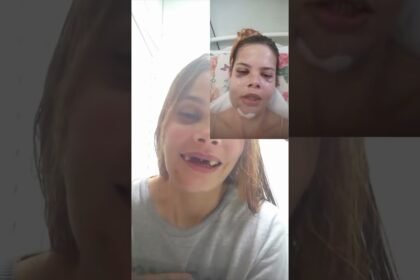 Jovem faz relato após sofrer gravíssimo acidente de moto! 💔🥺 Jovem faz relato após sofrer gravíssimo acidente de moto! 💔🥺