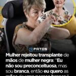 Mulher rejeitou transplante de mãos de mulher negra: “Eu não sou preconceituosa, mas sou branca, então eu quero as mãos de uma pessoa branca.