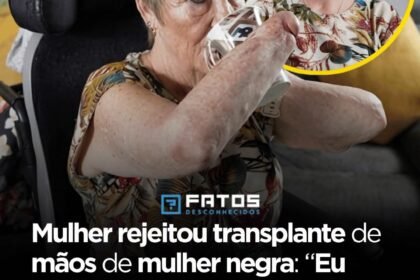 Mulher rejeitou transplante de mãos de mulher negra: “Eu não sou preconceituosa, mas sou branca, então eu quero as mãos de uma pessoa branca.