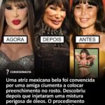 Uma atriz mexicana bela foi convencida por uma amiga ciumenta a colocar preenchimento no rosto. Descobriu depois que injetaram uma mistura perigosa de óleos. O procedimento mudou o rosto e a carreira dela pra sempre Uma atriz mexicana bela foi convencida por uma amiga ciumenta a colocar preenchimento no rosto. Descobriu depois que injetaram uma mistura perigosa de óleos. O procedimento mudou o rosto e a carreira dela pra sempre