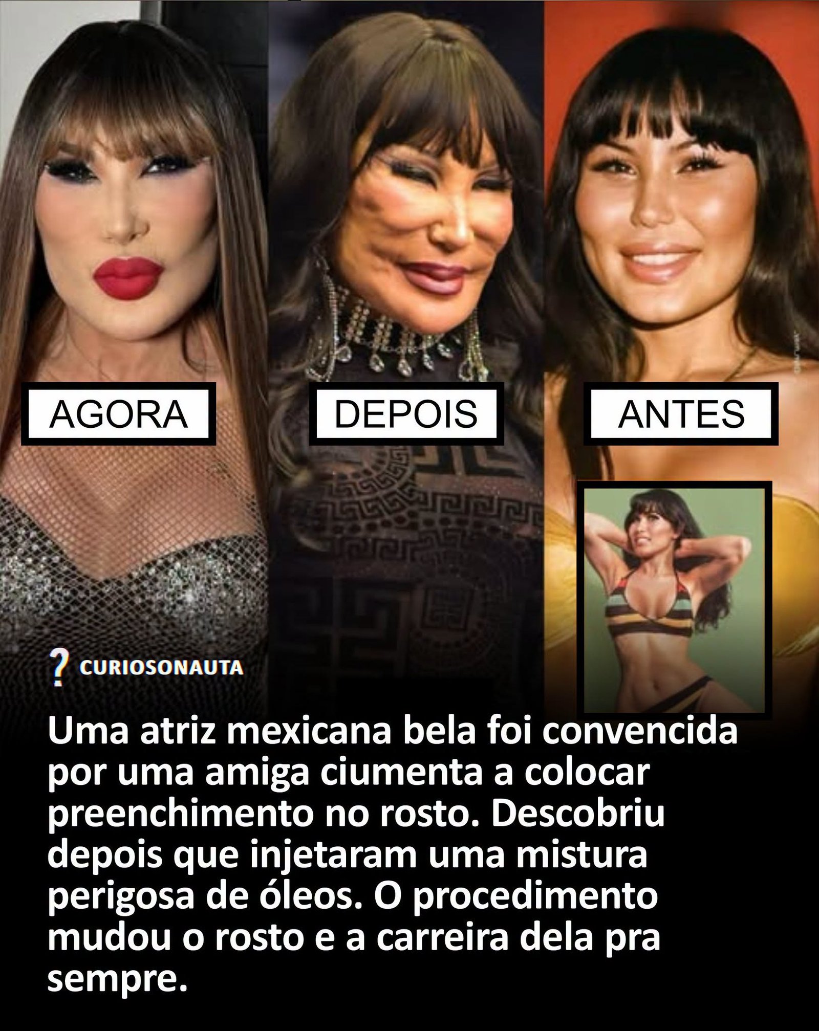 Uma atriz mexicana bela foi convencida por uma amiga ciumenta a colocar preenchimento no rosto. Descobriu depois que injetaram uma mistura perigosa de óleos. O procedimento mudou o rosto e a carreira dela pra sempre