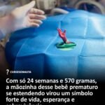 Com só 24 semanas e 570 gramas, a mãozinha desse bebê prematuro se estendendo virou um símbolo forte de vida, esperança e sobrevivência