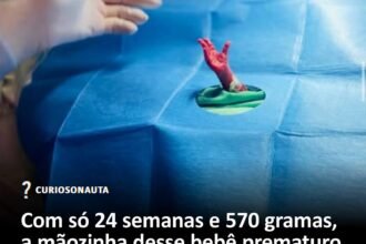 Com só 24 semanas e 570 gramas, a mãozinha desse bebê prematuro se estendendo virou um símbolo forte de vida, esperança e sobrevivência Com só 24 semanas e 570 gramas, a mãozinha desse bebê prematuro se estendendo virou um símbolo forte de vida, esperança e sobrevivência