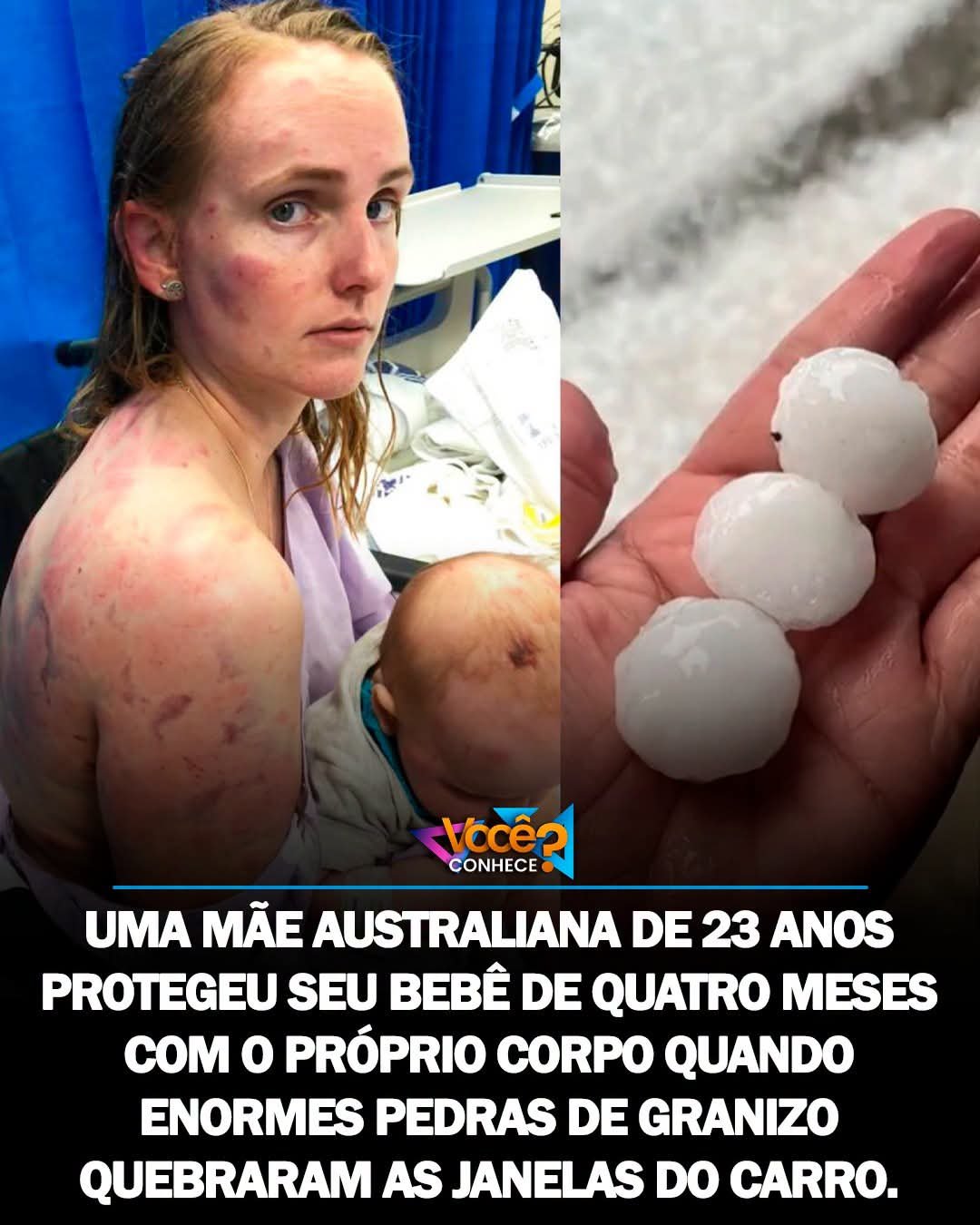 UMA MÃE AUSTRALIANA DE 23 ANOS PROTEGEU SEU BEBÊ DE QUATRO MESES COM O PRÓPRIO CORPO QUANDO ENORMES PEDRAS DE GRANIZO QUEBRARAM AS JANELAS DO CARRO. UMA MÃE AUSTRALIANA DE 23 ANOS PROTEGEU SEU BEBÊ DE QUATRO MESES COM O PRÓPRIO CORPO QUANDO ENORMES PEDRAS DE GRANIZO QUEBRARAM AS JANELAS DO CARRO.