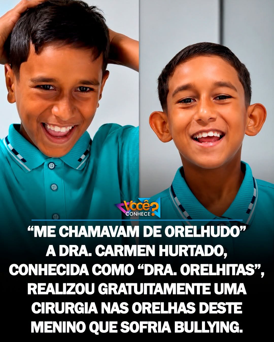 ME CHAMAVAM DE ORELHUDO” A DRA. CARMEN HURTADO, CONHECIDA COMO “DRA. ORELHITAS”, REALIZOU GRATUITAMENTE UMA CIRURGIA NAS ORELHAS DESTE MENINO QUE SOFRIA BULLYING.