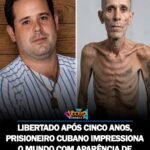 LIBERTADO APÓS CINCO ANOS, PRISIONEIRO CUBANO IMPRESSIONA O MUNDO COM APARÊNCIA DE EXTREMA DEBILIDADE.