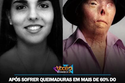 APÓS SOFRER QUEIMADURAS EM MAIS DE 60% DO CORPO E TER O ROSTO DESFIGURADO EM UM ACIDENTE PROVOCADO POR UM MOTORISTA EMBRIAGADO, JACQUELINE SABURIDO TRANSFORMOU SUA TRAGÉDIA EM UMA LUTA CONTRA O ÁLCOOL AO VOLANTE E SE TORNOU UM SÍMBOLO MUNDIAL DA CONSCIENTIZAÇÃO NO TRÂNSITO.