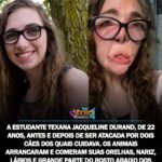ESTUDANTE TEXANA JACQUELINE DURAND, DE 22 ANOS, ANTES E DEPOIS DE SER ATACADA POR DOIS CÃES DOS QUAIS CUIDAVA. OS ANIMAIS ARRANCARAM E COMERAM SUAS ORELHAS, NARIZ, LÁBIOS E GRANDE PARTE DO ROSTO ABAIXO DOS OLHOS. ELA SOFREU MAIS DE 800 MORDIDAS E FICOU PERMANENTEMENTE DESFIGURADA. ESTUDANTE TEXANA JACQUELINE DURAND, DE 22 ANOS, ANTES E DEPOIS DE SER ATACADA POR DOIS CÃES DOS QUAIS CUIDAVA. OS ANIMAIS ARRANCARAM E COMERAM SUAS ORELHAS, NARIZ, LÁBIOS E GRANDE PARTE DO ROSTO ABAIXO DOS OLHOS. ELA SOFREU MAIS DE 800 MORDIDAS E FICOU PERMANENTEMENTE DESFIGURADA.