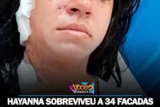 HAYANNA SOBREVIVEU A 34 FACADAS DADAS PELA AMANTE DO MARIDO.